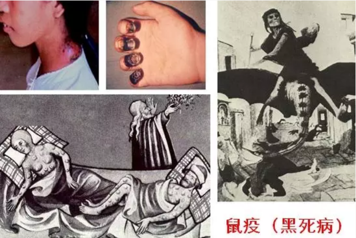 鼠疫一夜刷屏!为何如此可怕?这些预防知识请牢记!